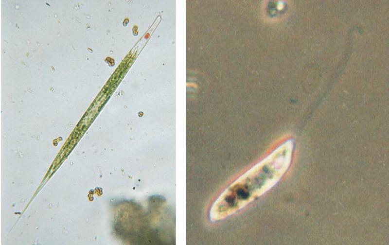 PING MacTrix - Protozoa series - new scans, #4 - Phacus oscillans & friends; DISPLAY FULL IMAGE.