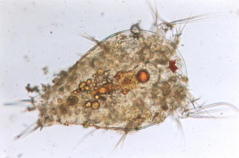 Protozoa - nauplius; DISPLAY FULL IMAGE.