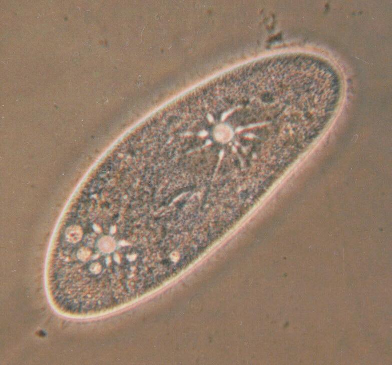 More Protozoa - The Secrets Of Paramecium Caudatum - KLEIN's silver lines; DISPLAY FULL IMAGE.