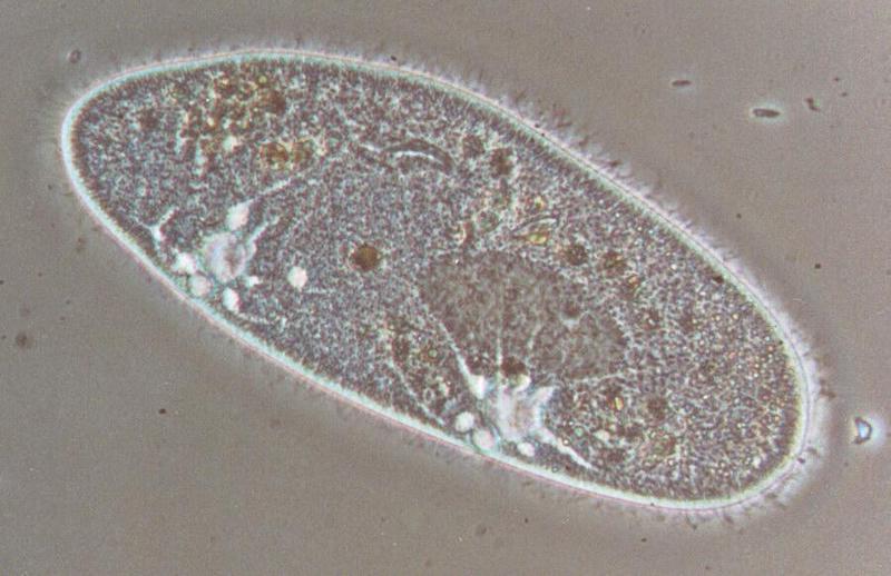 Protozoa - Paramecium caudatum take three - REPOST; DISPLAY FULL IMAGE.