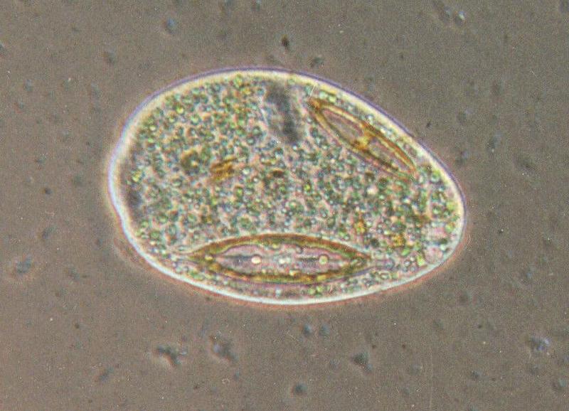 Protozoa series - REPOST #15 - Prorodon - new scans hopefully starting Friday; DISPLAY FULL IMAGE.
