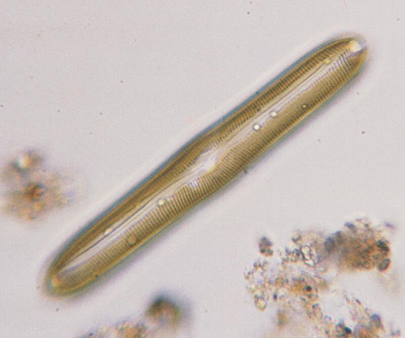 Protozoa - new scans, #2 - a hungry ciliate and its meal; DISPLAY FULL IMAGE.